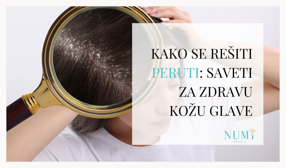Kako se rešiti peruti: saveti za zdravu kožu glave